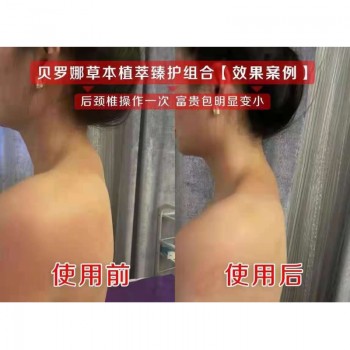 肩颈理疗